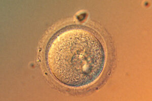 In a First, Scientists Precisely Edit Human Embryo Genes