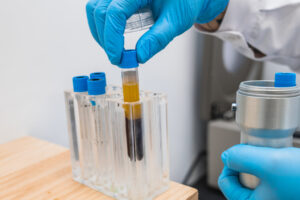 Early Research Suggests a Path to Predict and Prevent Lung Cancer