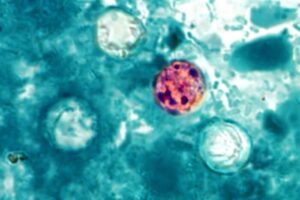 Trump admin shelves Cyclospora research despite record-breaking outbreak